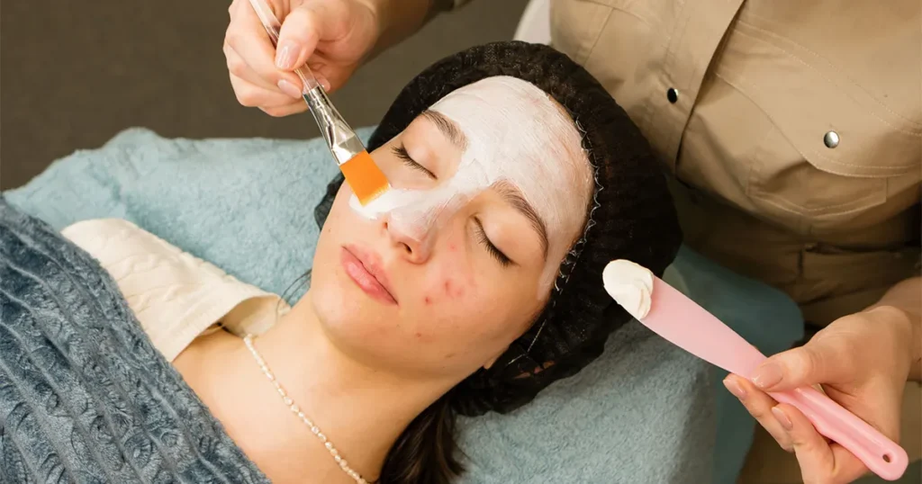 Understanding Acne: Causes, Treatment Options, and Prevention Tips Acne