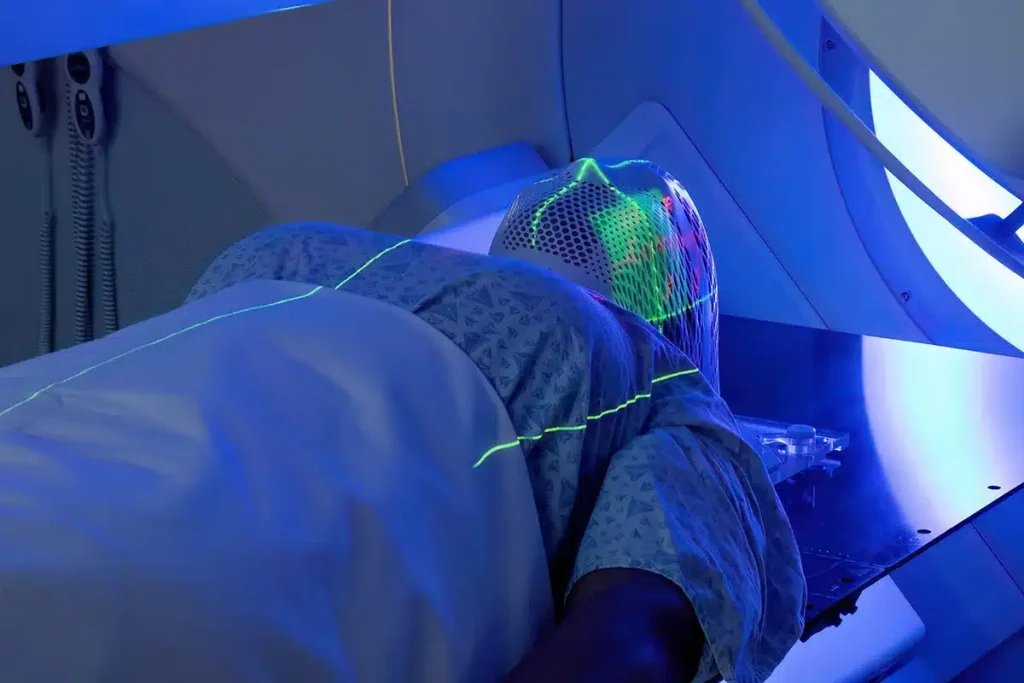 Exploring the Benefits of Cryoablation for Tumors Benefits of Cryoablation for Tumors