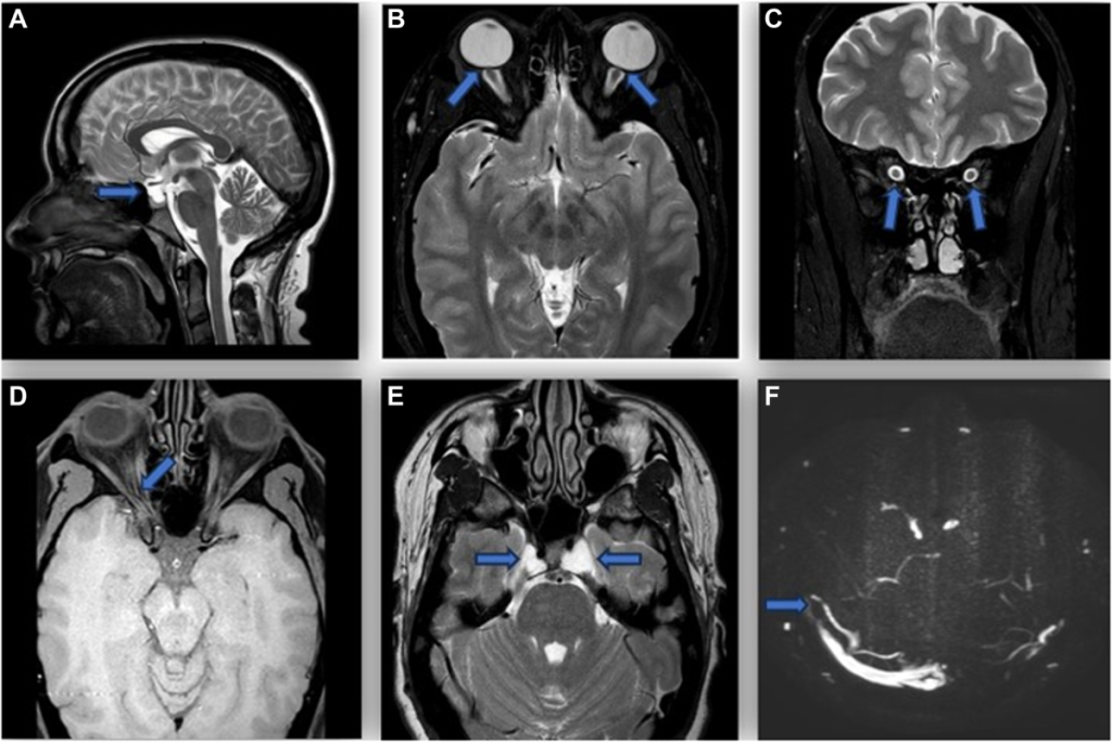 Diagnosing Vision-Related Brain Disorders