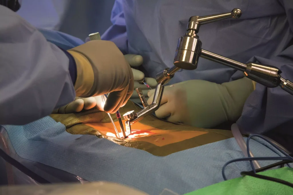 Understanding the Different Approaches to Spine Surgery Spine Surgery